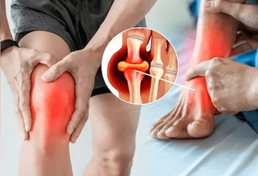 Shēma Icexin gela uzklāšanai ceļa locītavas un pēdas zonā